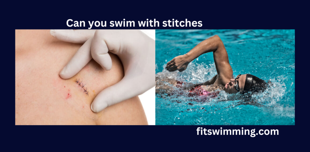 Can You Swim With Stitches? Complete Guide - Fit Swimming