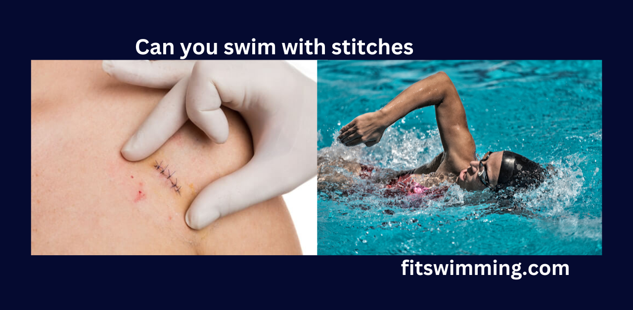 Can You Swim With Stitches? Complete Guide Fit Swimming