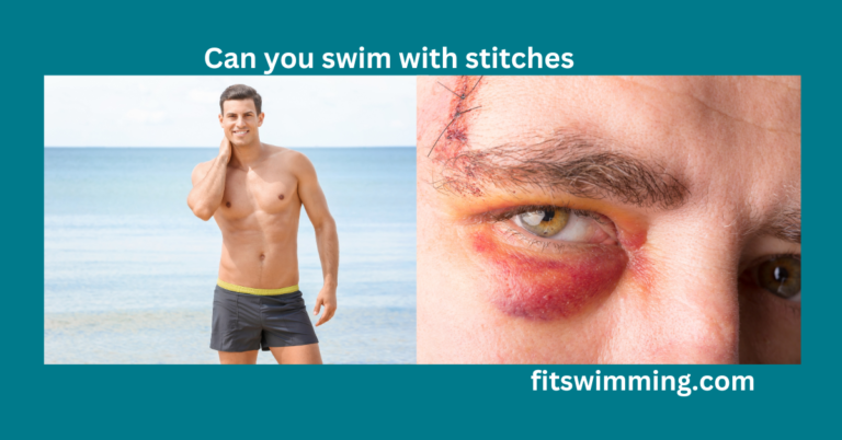 Can You Swim With Stitches? Complete Guide
