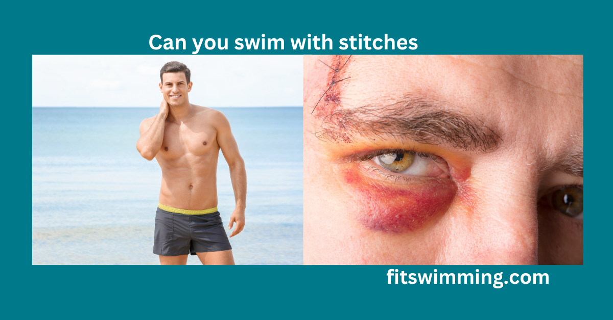 Can You Swim With Stitches? Complete Guide Fit Swimming