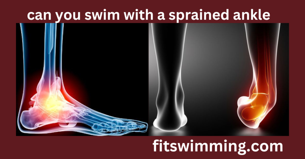 can-you-swim-with-a-sprained-ankle-precautions-and-benefits-fit-swimming